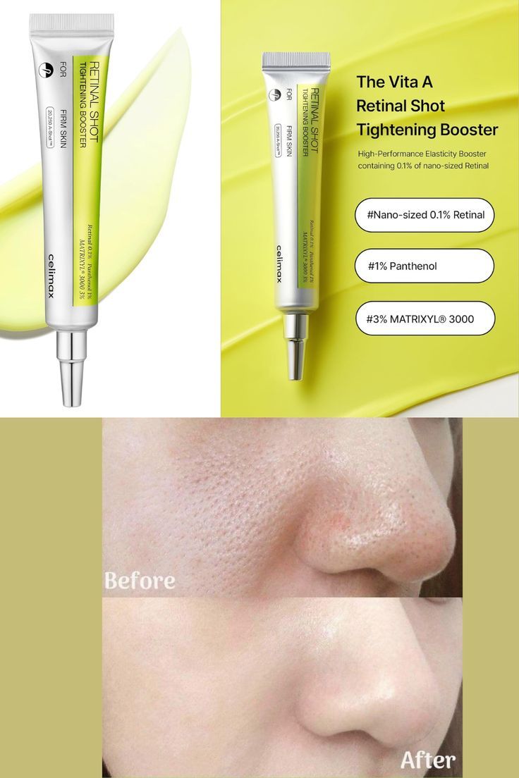 Celimax The Vita A Retinal Shot Tightening Booster For Melasma, Wrinkles & Fine Lines, Firmer Skin 15mL (For Now Buy-1 Get-1 Free) with 1 Surprise Gift