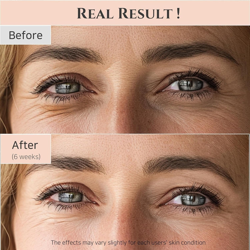 Beauty of Joseon Revive Eye Serum Awaken Your Eyes with Timeless Elegance